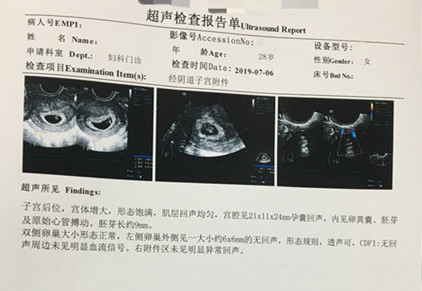 深圳28岁L女士不明原因性不孕，泰国做试管一次成功