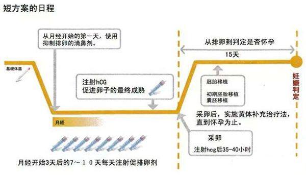 试管婴儿短方案流程