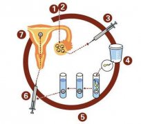 做泰国试管婴儿取卵数量越多越好,真的是这样吗?