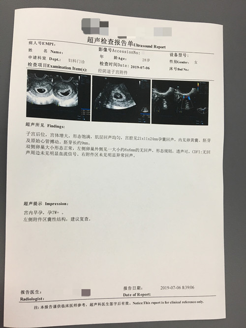 深圳28岁L女士不明原因性不孕，泰国做试管一次成功